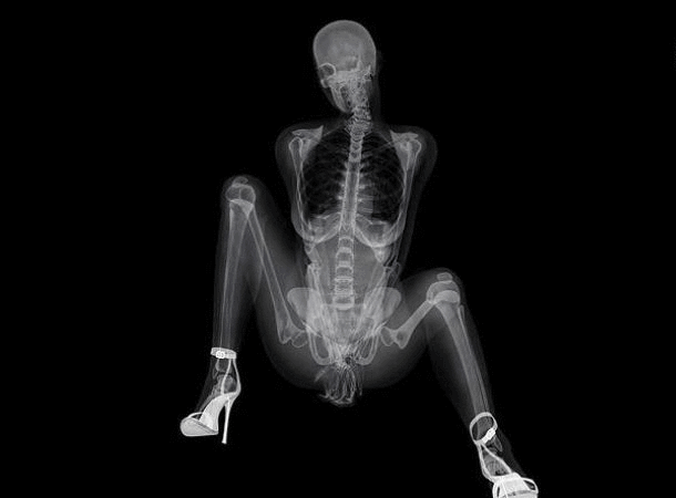 xxx-ray-skeleton